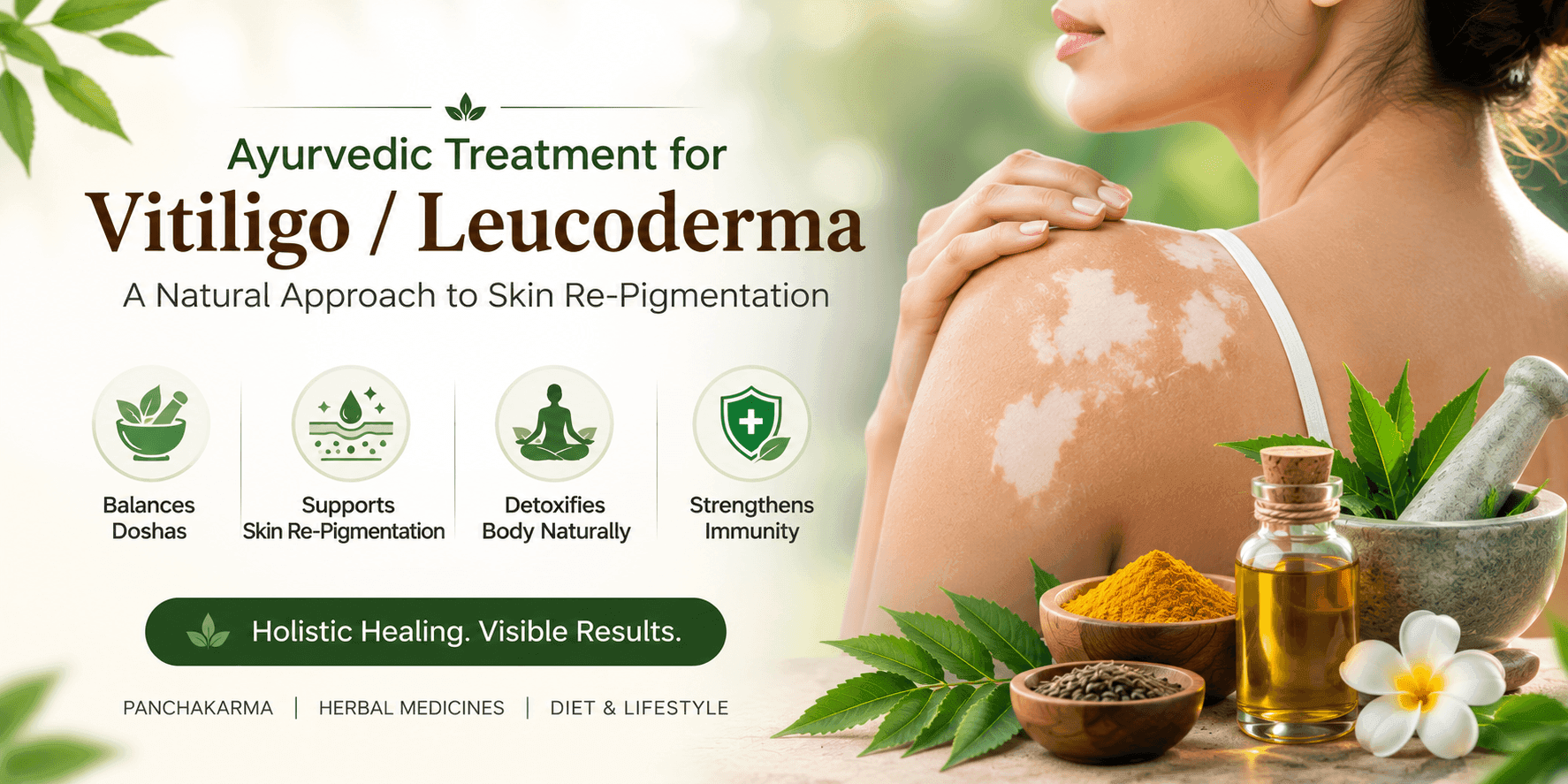 Ayurvedic Treatment Vitiligo Leucoderma.png